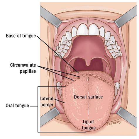 Tongue - Focus Dentistry