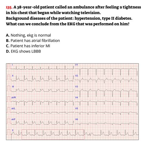 EKG Practice Course 的图像结果
