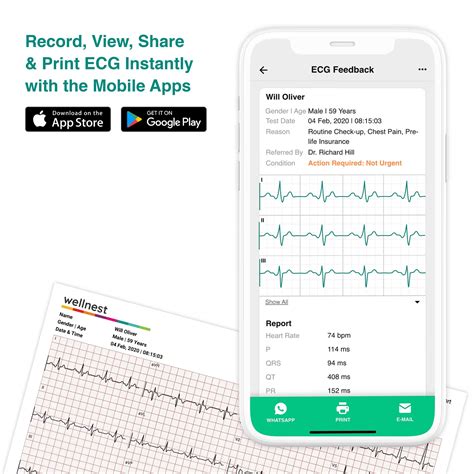 Buy Wellnest 12-Lead Pro 2 ECG System Online at Best Price - TenTabs