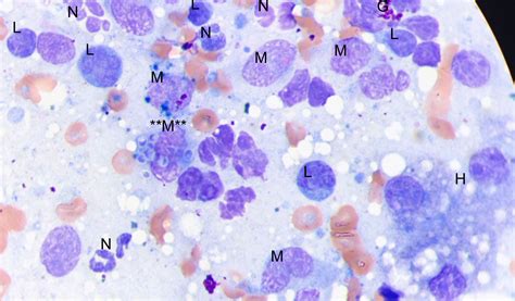 Veterinary Clinical Pathology: Cytology: Canine hepatic mass FNA