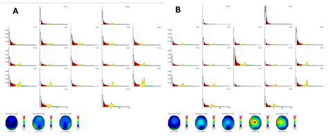 Non-Invasive Gamma Brain Wave Optimization for Cognitive and Emotional ...