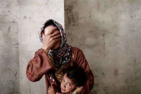 Turkish Clinics At Syrian Border Run Out Of Prosthetics Limbs Due To ...