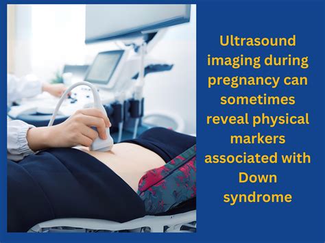 What are Signs of Down Syndrome During Pregnancy