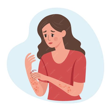 Woman scratches her hand allergic itching skin inflammation redness and ...