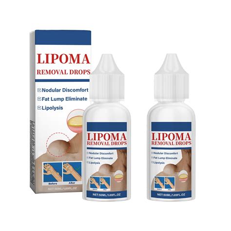 Herbal Lipoma Removal Drops Lipoma Removal Lipoma Removal Cream Creating | Desertcart South Africa