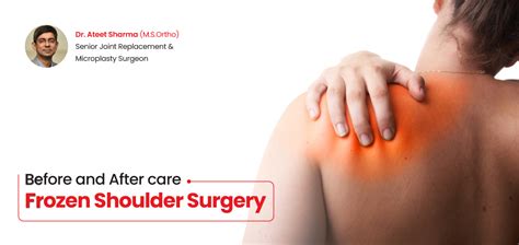 Before and After Frozen Shoulder Surgery: Real Patient Journeys