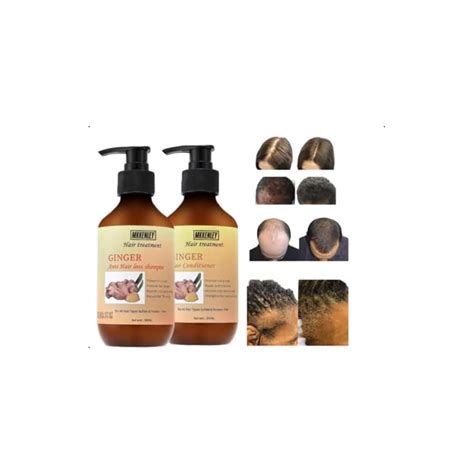 Anti Hair Loss Ginger Shampoo And Conditioner India | Ubuy