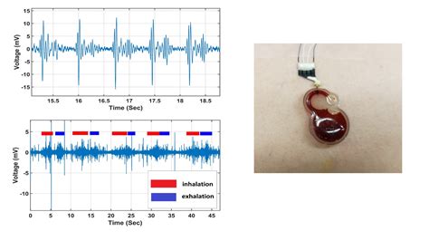 Continuous Cardiac Monitoring Defib 的图像结果