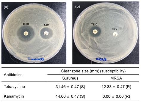 Interdigitated and Wave-Shaped Electrode-Based Capacitance Sensor for ...