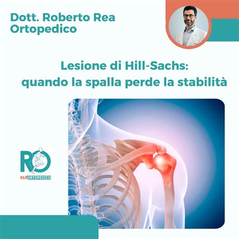 Lesione di Hill Sachs - REA ORTOPEDICO