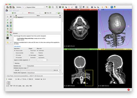 Image result for Code Segment Editor