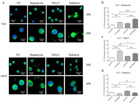 Lysosomes Dysfunction Causes Mitophagy Impairment in PBMCs of Sporadic ...
