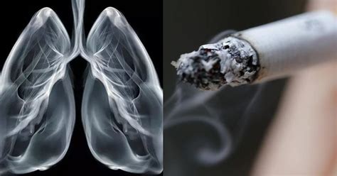 Light And Heavy Smoking Impact Lungs In The Same Adverse Way And Cause ...