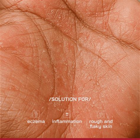 1% Ceramides Intensive Repair Cream