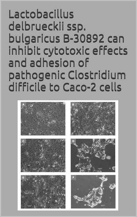 Lactobacillus delbrueckii ssp. bulgaricus B-30892 can inhibit cytotoxic ...