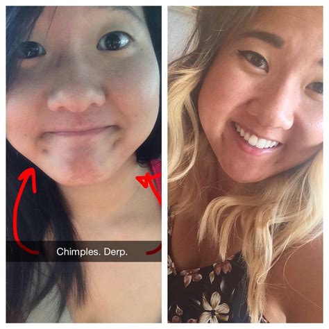 overview for mini_Oppa