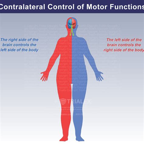 Image result for Graffted Contralateral