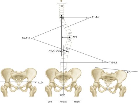 Image result for Spinal Alignment