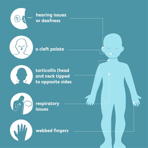 Klippel-Feil Syndrome: Symptoms, Causes, Diagnosis, and Treatment
