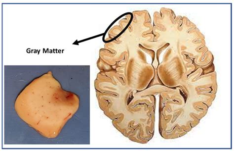 Beyond The Gray Matter: How The Human Brain Actually Looks