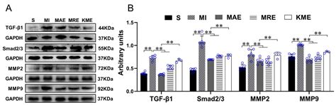 Exercise Training Alleviates Cardiac Fibrosis through Increasing ...