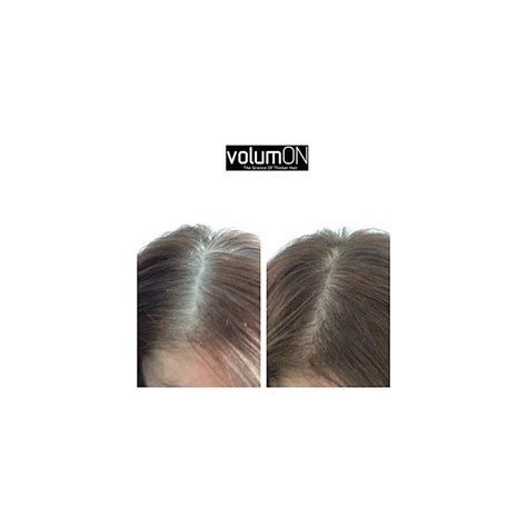 Volumon Hair Loss Concealer and Root Cover Up - Make India | Ubuy
