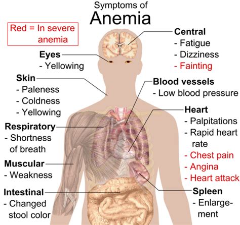 Anaemia And Bruising