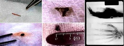 Image result for Alien Implants Just Schrapnel
