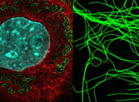 Super Resolution Microscopy - ZMB UZH