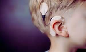 Early Cochlear Implantation Preserves Auditory Nerve Health and ...