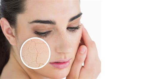 Skin Types 的图像结果