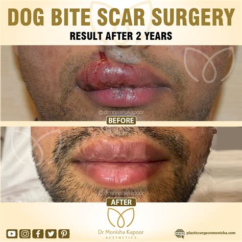 How To Treat A Dog Bite On The Face