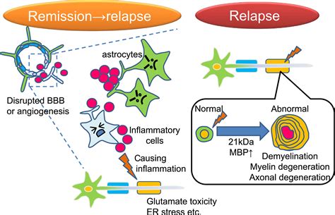 Mechanisms Of Remyelination: Recent Insight From Experimental Models – YLEAV