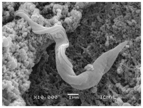 What Do You Need to Know before Studying Chagas Disease? A Beginner’s Guide