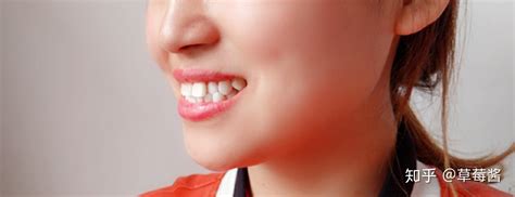 全瓷牙冠 - 林口牙醫診所推薦—康澤牙醫，給您用心、溫馨的優質醫療服務