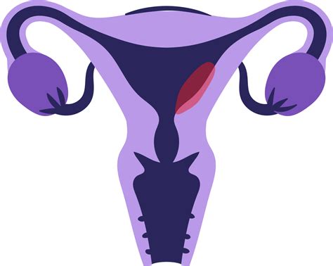 A Simple Guide To Understanding Cancer (Part 1)