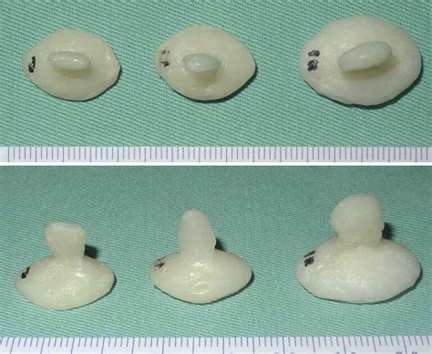 Image result for Splint Sizes