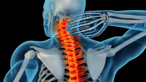 Spinal Stroke: పెరుగుతున్న స్పైనల్ స్ట్రోక్ కేసులు..స్పైనల్ స్ట్రోక్ ...