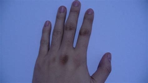 手背和手指连接处、手指关节处皮肤发黑，什么原因？_百度知道