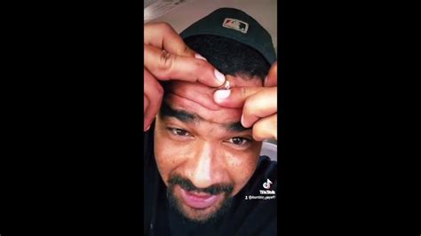 Exploding Cysts Compilation 的图像结果