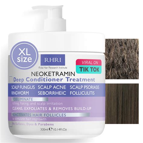 Anti Fungal Deep Conditioner For Men And Women Scalp Treatment ...