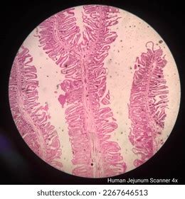 Image result for Jejunum Microscope