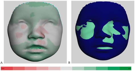 JCM | Special Issue : Cleft Lip and Palate Patient: New Challenges in ...