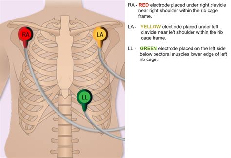 Ecg 3 Leads Placement The ECG Leads: Electrodes, Limb Leads, Chest
