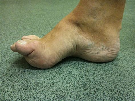 Common Foot Problems - Foot Pain Centres of Leeds