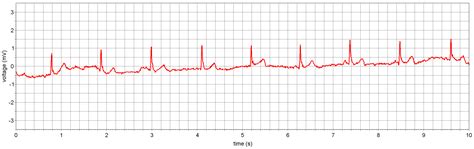 Remotely Powered Two-Wire Cooperative Sensors for Biopotential Imaging ...