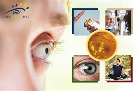 Diabetic Eye Problems 的图像结果