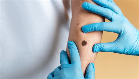 VenkateswaraDental Clinic Implant Centre- Skin prp