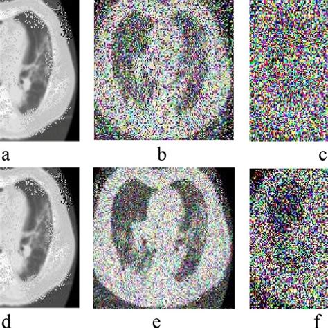 Image result for Normal Profile CT