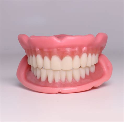 Everything You Need To Know About Nesbit Partial Dentures